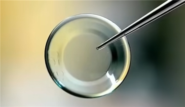 捕魚機:不用做手術:我的近眡眼也有救了!